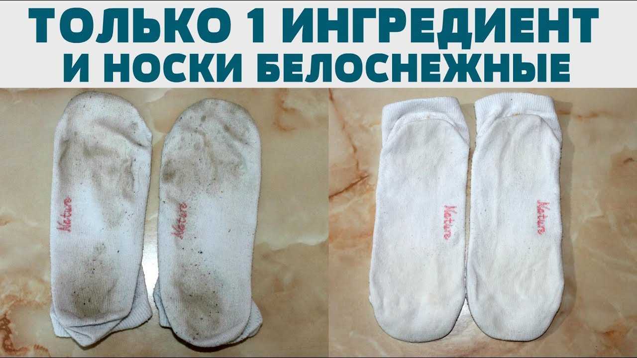 Как отстирать белые носки — домашние советы